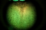 velscope image